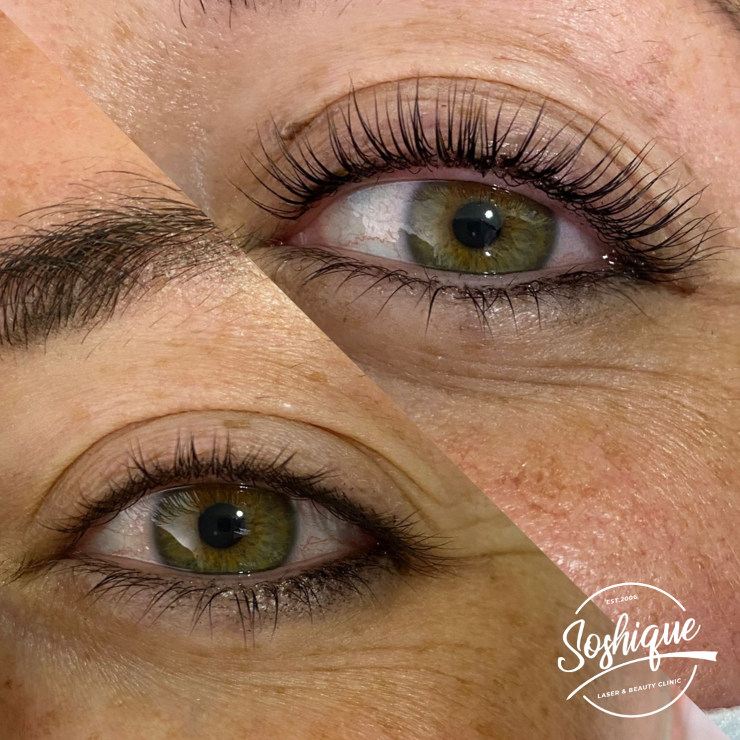 Read more about the article Can you tell this is just a LASH LIFT?