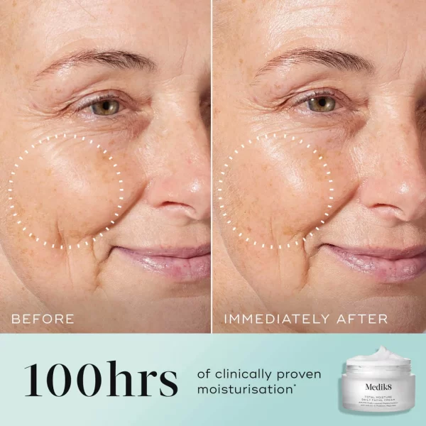Medik8 Total Moisture Daily Facial Cream - 50ml - Image 3